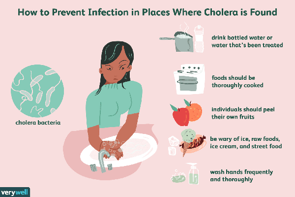 Cholera prevention